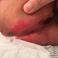 哈哈，怎么说呢我闺女太敏感了， 记得刚出生那时候用好奇，好奇纸尿裤侧漏严重，每次打开包裹，她都尿的...