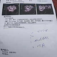 今天检查医生说一切正常，二胎希望来个女宝宝😊