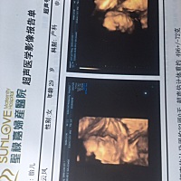 二宝好不容易配合羞涩的露了个脸，看看我家二宝像谁