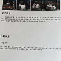 月经不正常，大家帮我看看多少周了？