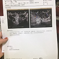 之前5个月没有来月经，去看了妇科医生说照B超和开黄体酮吃，开了一个星期的时间，停药后5天来了月经，今...