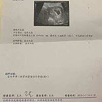 刚刚才怀孕的新妈妈～好多都不懂～