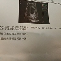 谁会看男女，帮忙看一下呗