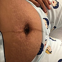 产后的肚子都不是肚子，哈哈，不忍直视😹😹