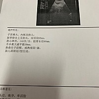 5月26预产期是不是胎儿偏大呀，医生算的现在都已经38周＋了