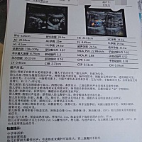 亲们帮我看看是男宝贝还是女宝贝，谢谢！