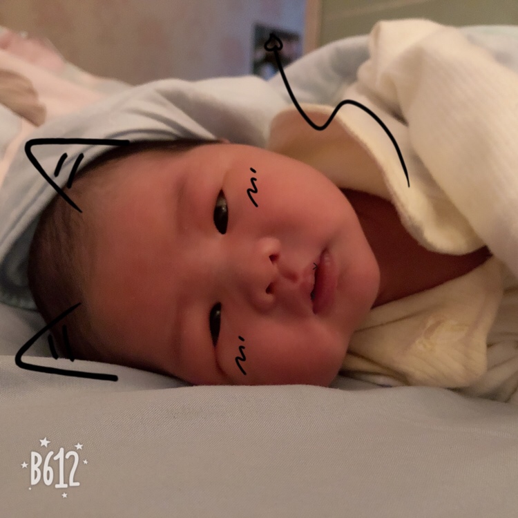 剖腹产八斤小坏蛋，伤口那么疼，看到你就觉得一切都值得！