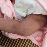 宝宝身上有红点是怎么回事啊    过两天不下    就去医院看看    有知道的宝宝吗？