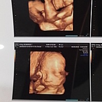 每天感受宝宝在肚子里面调皮的时候就是最幸福的事情，愿宝贝平平安安出生