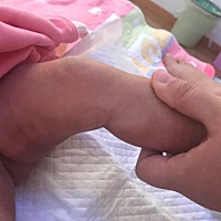 有宝妈知道是什么吗，去医院看排除了白癜风，就让回来观察观察，医生也说不出个所以然，出生的时候没有...