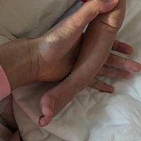 宝妈们 我家宝宝的脚往里翻是怎么回事啊 这正常吗