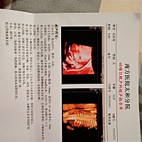 能看出是男孩女孩麽！帮忙看看