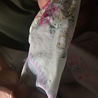 请问宝宝出生半个月了，今天发现尿布上有透明果冻状颗粒，有哪位经历过的宝妈知道什么情况么，在线等