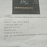 现在是23周了，帮忙看看是男孩女孩，大宝是女孩现在三岁了，想要儿女双全。