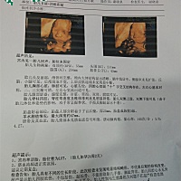 特开心四维顺利通过，胎盘也顺利涨上去了，发现二宝跟大宝长得好象。