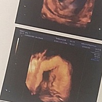 感觉四维挺靠谱，越来越喜欢，就是不要吃奶就行，一吃奶我好痛，害怕