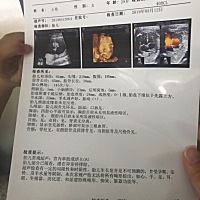 今天做的四维，身边的人都说像我，是男孩。