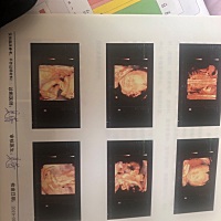 有人会看男女吗，帮忙看一下，谢谢