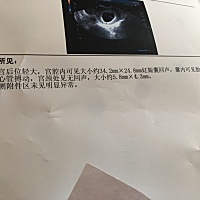 怀孕46天走血，是不是保不住了？