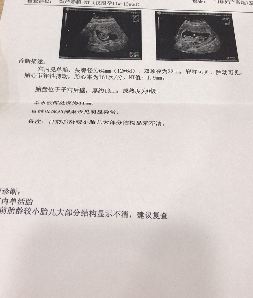 这个是12周多的时候做的NT，帮我看下是男是女