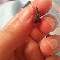 宝宝14天脐带脱落！