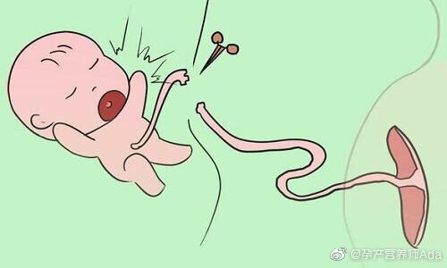 via：孕产营养师Ada