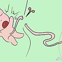 【新生儿脐带如何护理？ 】 1 、一般情况下，宝宝的脐带会在1周左右自己脱落，2周左右自动愈合。 这...