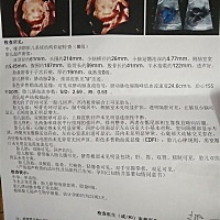 不知男女，但是头胎好想是男宝宝，目前女宝宝富养不起😂，有会看的么