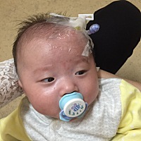 早产娃就是容易感染呜呜