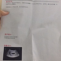 今天刚去医院检查了，宫内早孕5周＋，未见胚芽和心管博动，验血了，医生说我的指标蛮高的，按照道理应该...