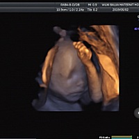 越看越觉得像乔治，尽管已知是佩奇