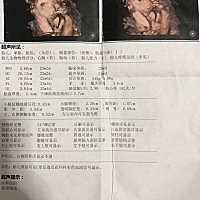 今天做了四维，宝宝睡着了，做了第二次还把手挡住脸了～哈哈哈～看的不清楚，不过还是感觉好可爱呀～有...