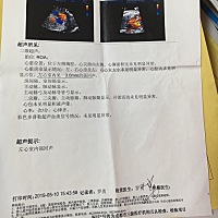 四维，胎儿心脏不过关，医生说娃娃的智力有问题，心焦……