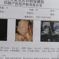 有会看男女的吗？第一胎可好奇了，还有50天就出来了