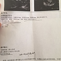 听说NT可以看出男孩女孩吗