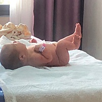 二胎剖腹产，一点不觉得痛，第二天下地走路，第三天直立行走，今天第四天和正常人没区别了。头胎剖宫产...