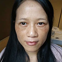 大家知道长斑怎么办嘛