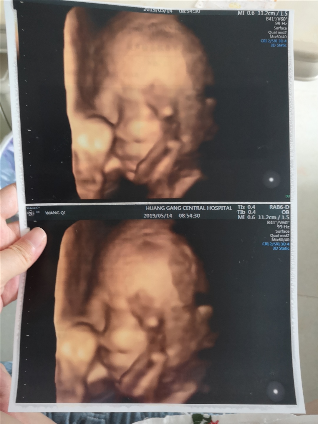 宝宝好像长的不好看啊😔