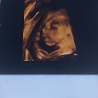 昨天照的四维 一次通过了 看得出来乔治还是佩琦吗😊