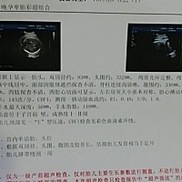 大家来猜一下，马上待产