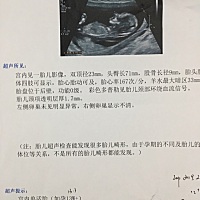 其他正常。就脖子被这样 不要紧吧各位
