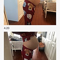 讲下生产过程 39周早上8点正常去产检，胎心监护后 医生说宫缩规律，建议住院，当时没感觉到痛，但确...