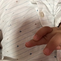 我家宝宝这两天手指一直这样叠着放，弄下去又自己搭上去了，有没有宝妈知道是为什么？？