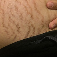 哭了，有没有什么办法或者方法拯救肚皮？