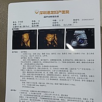 宝宝麻麻粑粑爱你，今天做的四维，谁会看男女