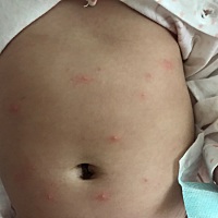 我的宝宝三个月前一直喝母乳，三个月后跟羊奶粉混合着喝，反复便秘，两三天拉一次或四五天拉一次，后来...