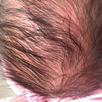 请问下有没有知道28天的宝宝头皮里长了一些小白点是什么东西的宝妈？