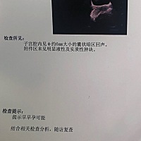 4月3号末次月经，5月3日、4日测出，5月5日验血怀孕，今天做了b超，医生说月份还小，大部分的可能是宫内...