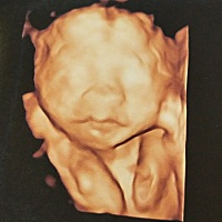 准妈妈都来接四维一次通过啦.