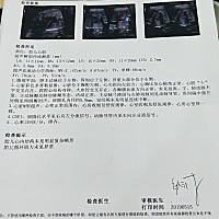 都说四维可以看出男宝女宝，麻烦大家帮我看一下，宝宝今天很配合，为了糖耐能一起做，四维的时候都是空...